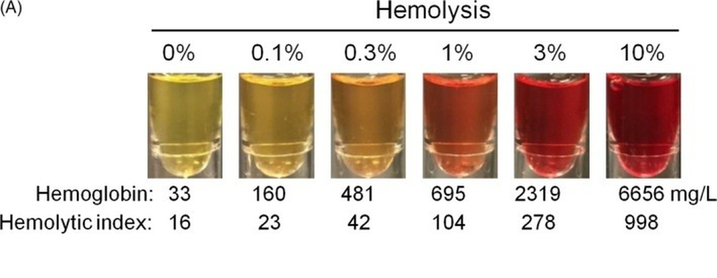 Serum tubes showing increasing hemolysis from 0% to 10%, with matching hemoglobin and hemolytic index values