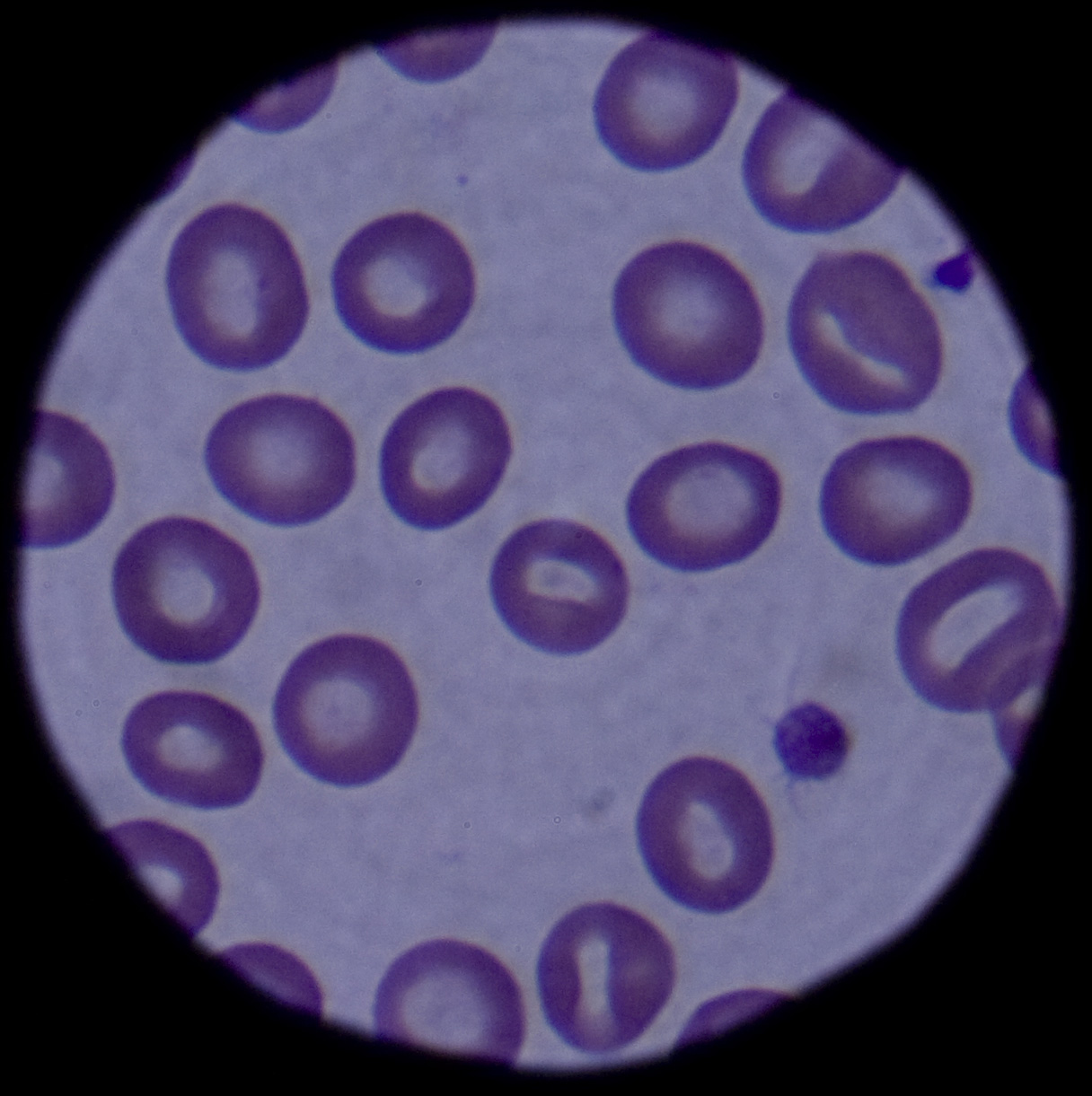 A light-microscope field contains many round red blood cells with pale centers and small purple-stained elements.