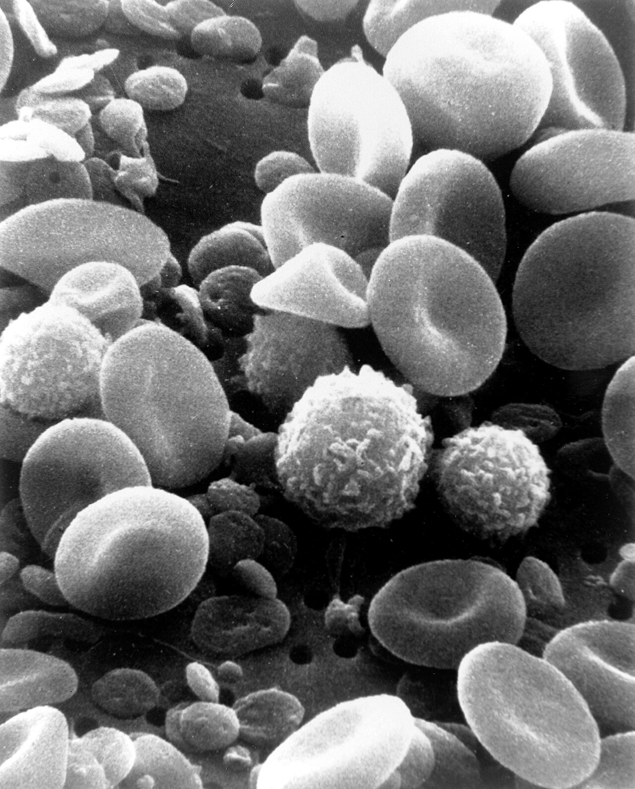 A black-and-white scanning electron micrograph shows disc-shaped red cells and textured white cells.
