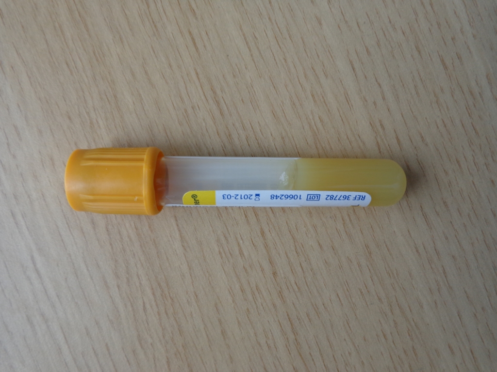 An unused yellow-capped collection tube lying on a wooden surface, with product, lot, and expiry markings.