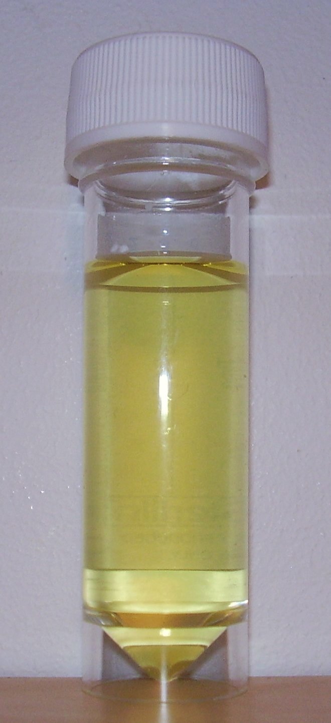 Yellow urine in a clear screw-capped specimen container with no visible patient label.